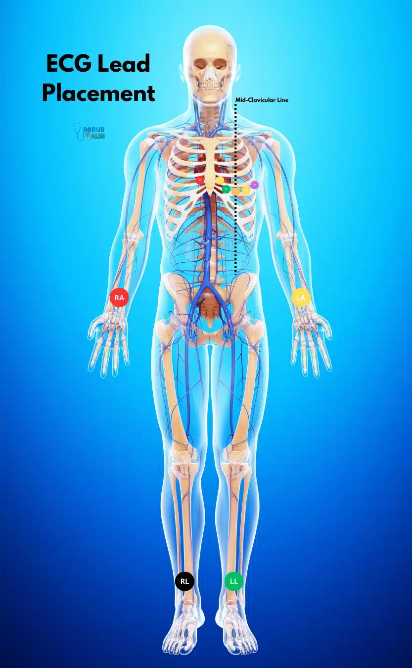 ECG Lead Placement ScrubTales