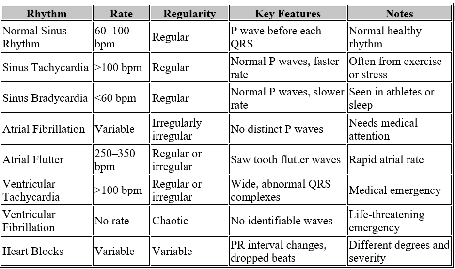 ECG Summary Table