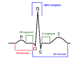 ECG waves